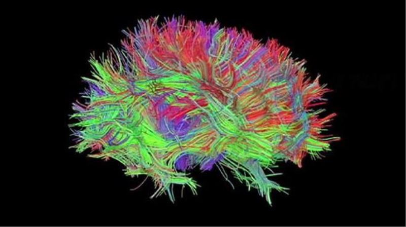 Beyin cerrahisinde hologram dönemi