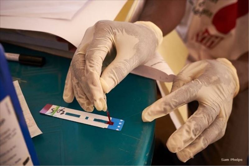 HIV´le mücadelede antiretroviral terapi yaşam süresini arttıracak